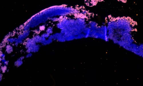 Visualisierung und Quantifizierung von Biofilmen